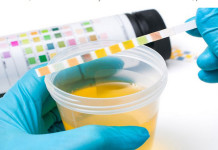 Mitos & Verdades: Cor da urina pode revelar doenças renais ou do fígado?